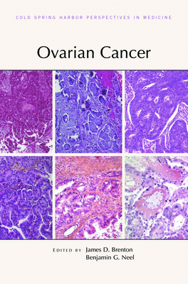 Ovarian Cancer 1621822354 Book Cover