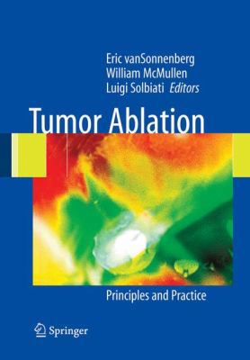 Tumor Ablation: Principles and Practice 0387955399 Book Cover