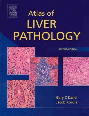 Atlas of Liver Pathology 0721600190 Book Cover