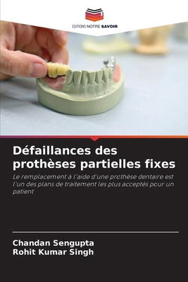 Défaillances des prothèses partielles fixes [French] 6207552059 Book Cover