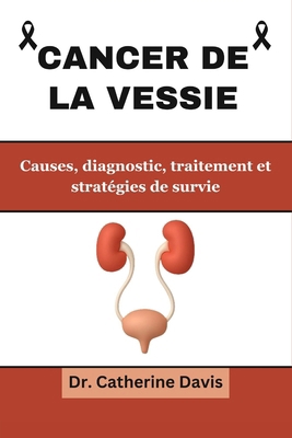 Cancer de la vessie: Causes, diagnostic, traite... [French] B0CWV2RLK6 Book Cover