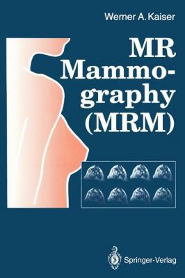 MR Mammography (Mrm) 3642772587 Book Cover