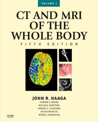 CT and MRI of the Whole Body B007YXZQMI Book Cover