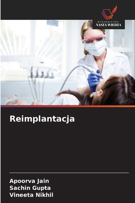Reimplantacja [Polish] 620074923X Book Cover