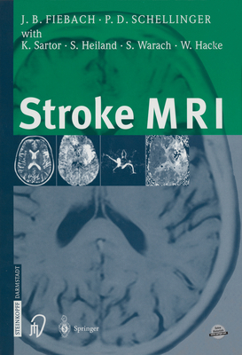 Stroke MRI 364263253X Book Cover