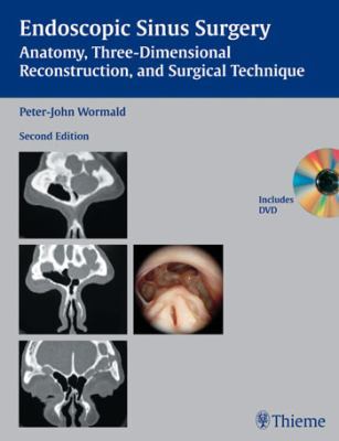 Endoscopic Sinus Surgery: Anatomy, Three-dimens... [German] 3131394226 Book Cover