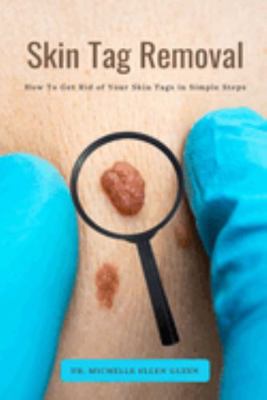 Skin Tag Removal : How to Get Rid of Your Skin Tags in Simple Steps