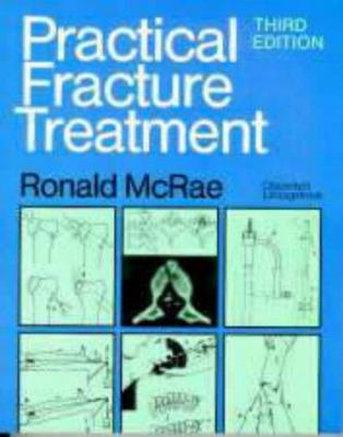 Practical Fracture Treatment 0443048096 Book Cover