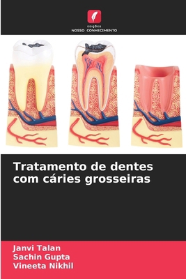Tratamento de dentes com cáries grosseiras [Portuguese] 6207766822 Book Cover
