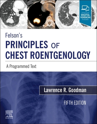 Felson's Principles of Chest Roentgenology, a P... 0323625673 Book Cover