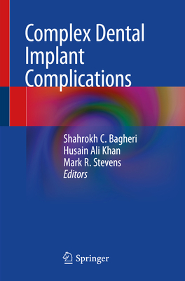 Complex Dental Implant Complications 3030470148 Book Cover