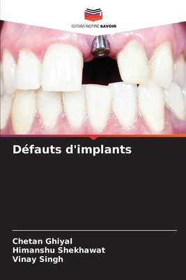 Défauts d'implants [French] 6208387183 Book Cover