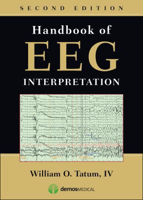 Handbook of Eeg Interpretation 1620700166 Book Cover