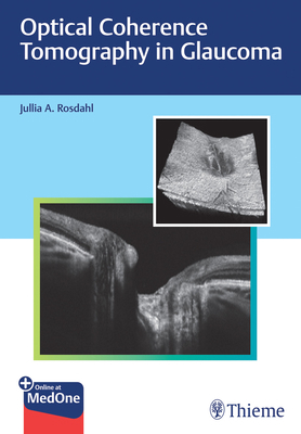 Optical Coherence Tomography in Glaucoma 1684202477 Book Cover