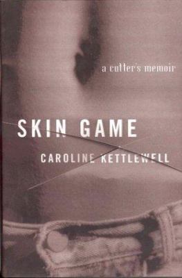 Skin Game 0312200110 Book Cover