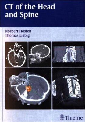 CT of the Head and Spine 1588900398 Book Cover