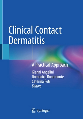Clinical Contact Dermatitis: A Practical Approach 3030493342 Book Cover