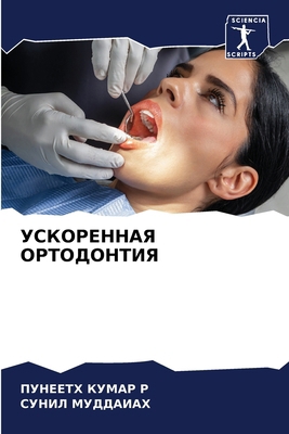 &#1059;&#1057;&#1050;&#1054;&#1056;&#1045;&#105... [Russian] 6207664590 Book Cover