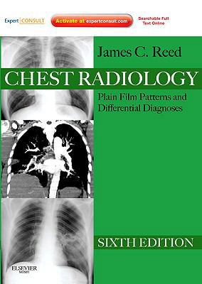Chest Radiology: Plain Film Patterns and Differ... B0082M4WNY Book Cover