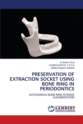 Preservation of Extraction Socket Using Bone Ri... 6209062776 Book Cover