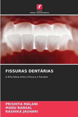 Fissuras Dentárias [Portuguese] 6209094112 Book Cover