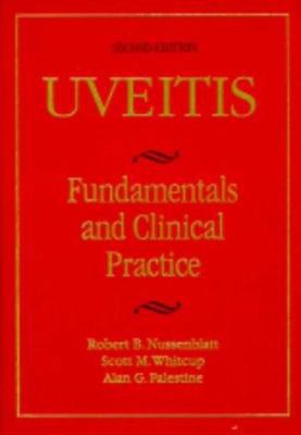 Uveitis: Fundamentals in Clinical Practice 0815164467 Book Cover