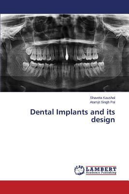 Dental Implants and Its Design 3659592293 Book Cover