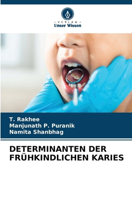 Determinanten Der Frühkindlichen Karies [German] 6200694575 Book Cover