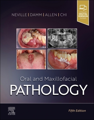 Oral and Maxillofacial Pathology 0323789811 Book Cover