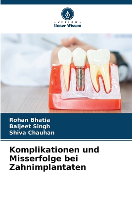 Komplikationen und Misserfolge bei Zahnimplantaten [German] 6208232708 Book Cover