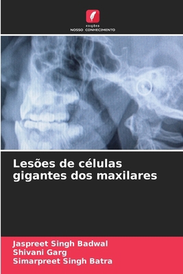 Lesões de células gigantes dos maxilares [Portuguese] 620835756X Book Cover