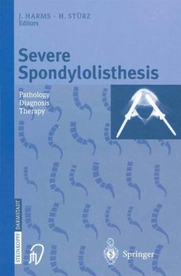 Severe Spondylolisthesis Pathology Diagnosis Th... 3798513791 Book Cover