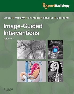 Image-Guided Interventions: Expert Radiology Se... 1416029648 Book Cover