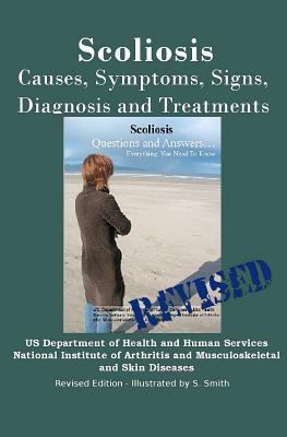 Scoliosis: Revised Edition: Causes, Symptoms, S... 1470051931 Book Cover