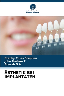 Ästhetik Bei Implantaten [German] 6208190061 Book Cover