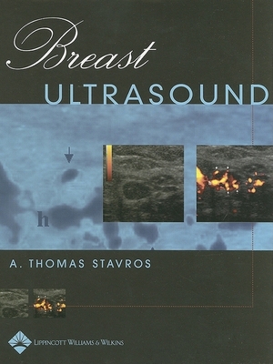 健康・医学 Breast Ultrasound A. Thomas Stavros Breast Ultrasound: 9780397516247: Medicine & Health Science