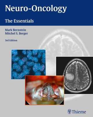 Neuro-Oncology: The Essentials 1604068833 Book Cover