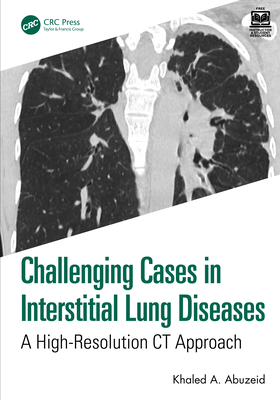 Challenging Cases in Interstitial Lung Diseases... 1032950056 Book Cover