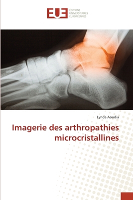 Imagerie des arthropathies microcristallines [French] 6206709477 Book Cover