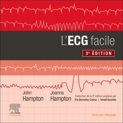 L'Ecg Facile [French] 2294779266 Book Cover