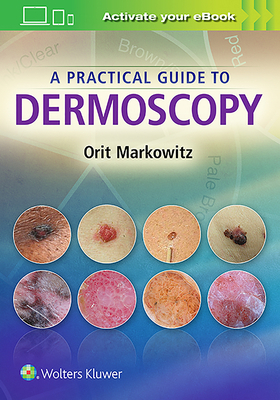 A Practical Guide to Dermoscopy 1451192630 Book Cover