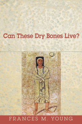 Can These Dry Bones Live? 1608998851 Book Cover