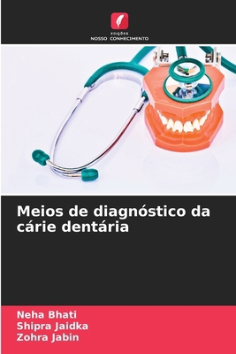 Meios de diagnóstico da cárie dentária [Portuguese] 6207064089 Book Cover