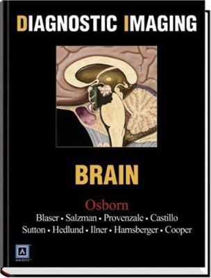 Diagnostic Imaging Brain B002Z3LAF4 Book Cover