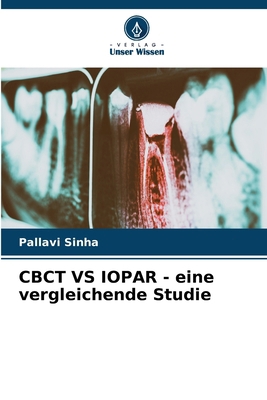 CBCT VS IOPAR - eine vergleichende Studie [German] 6207664248 Book Cover