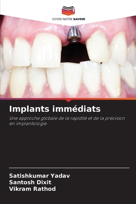Implants immédiats [French] 6208060478 Book Cover
