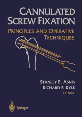 Cannulated Screw Fixation: Principles and Opera... 038794463X Book Cover