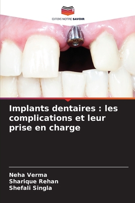 Implants dentaires: les complications et leur p... [French] 6205760266 Book Cover