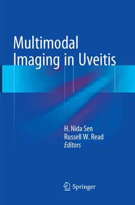 Multimodal Imaging in Uveitis 3319795236 Book Cover