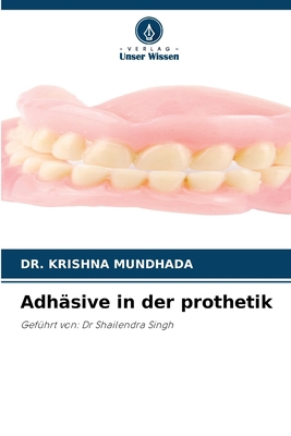 Adhäsive in der prothetik [German] 6209623654 Book Cover